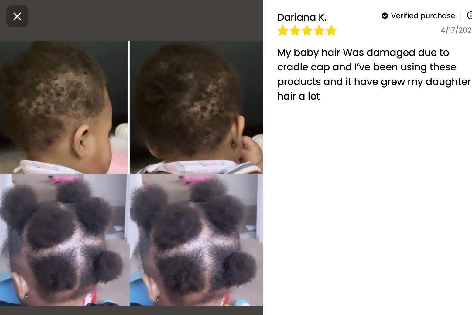 Kid's Hair Growth Scalp Stimulator