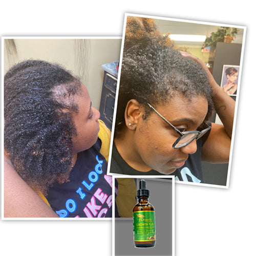 Growth-Plus Hair Oil